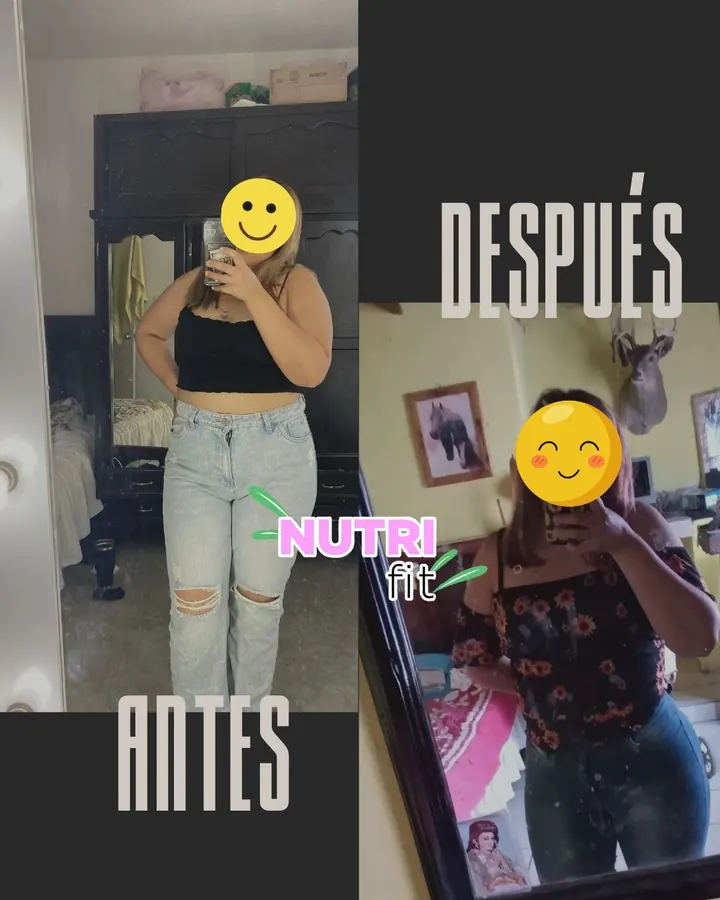 Resultado antes y después compartido por una paciente
